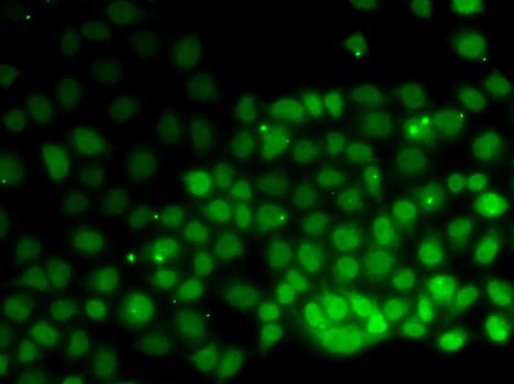 HMGN2 Antibody