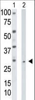 TK2 Antibody (aa8-38)