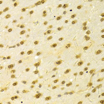 HDGF Antibody