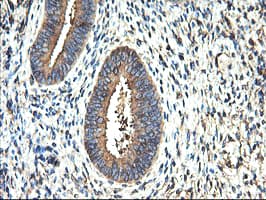 TUBAL3 Antibody (aa150-446, clone OTI1G6, Carrier-free)