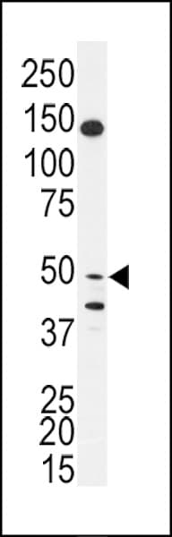 Polyclonal Rabbit anti-Human BPIFB2 Antibody (aa85-115, WB)