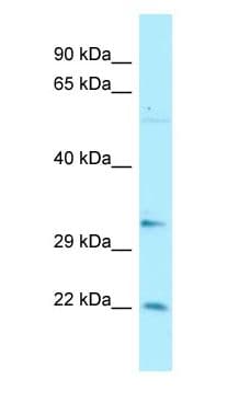 BRMS1 Antibody (aa186-235)