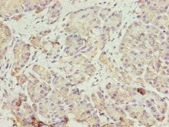 Polyclonal Rabbit anti-Human ERO1LB Antibody (IHC, WB)