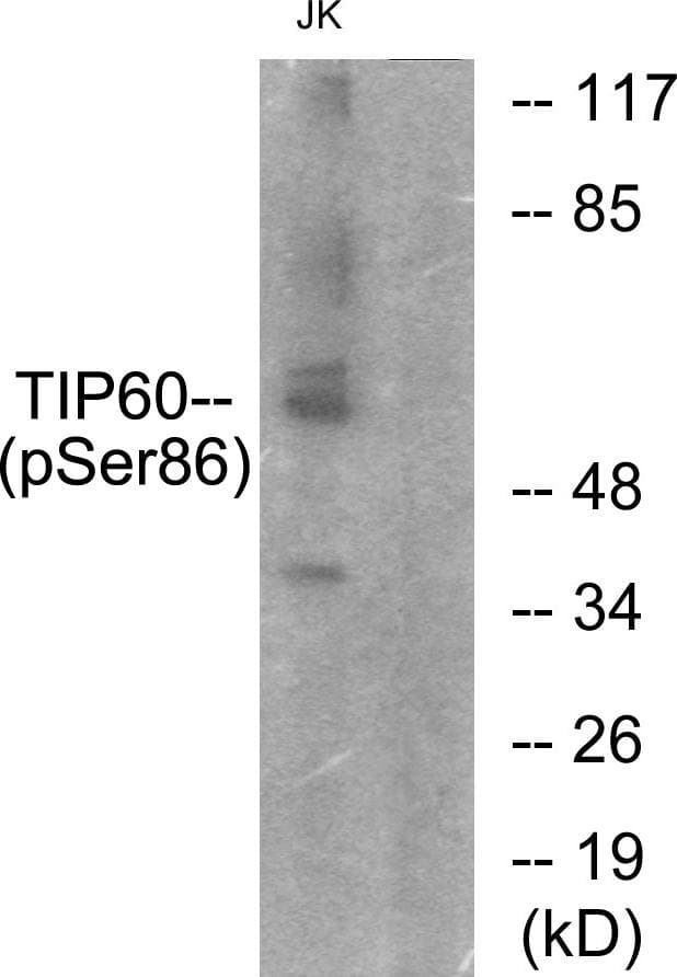 Polyclonal Rabbit anti-Human KAT5 / TIP60 Antibody (phospho-Ser86, WB)