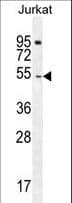 DARS Antibody (aa154-183)