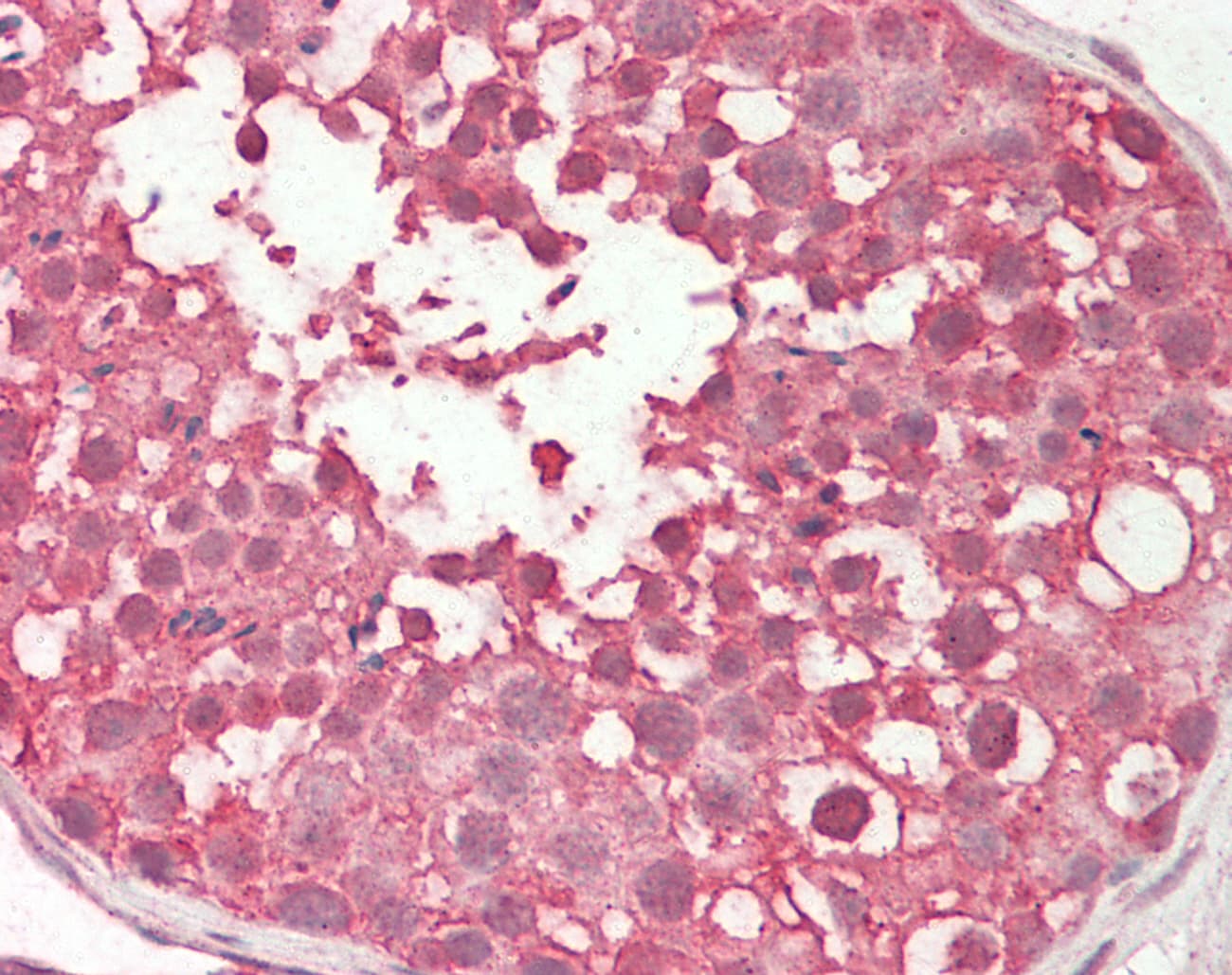 Polyclonal Rabbit anti-Human PPP2R4 Antibody (aa271-320, IHC, WB)