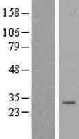 TIMMDC1 Protein (Over-Expression Lysate Myc-DDK (Flag))