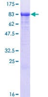 Human PAPSS 1 Protein (Recombinant GST)