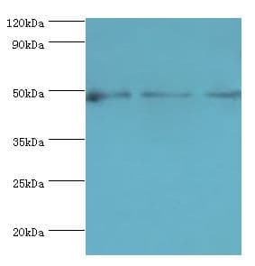 DCP2 Antibody (aa1-240)