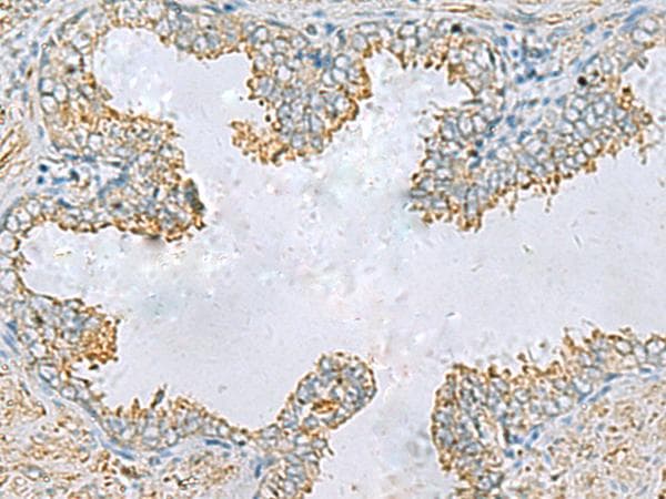 PLA2G15 / ACS Antibody