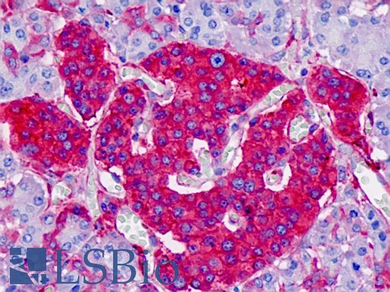 IHC-plus™ Monoclonal Rabbit anti-Human DPYSL2 / CRMP2 Antibody (clone EPR7792, C-Terminus, IHC, WB)