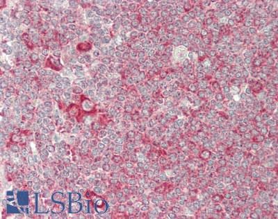 IHC-plus™ RPL26 / Ribosomal Protein L26 Antibody (aa100-C-term)