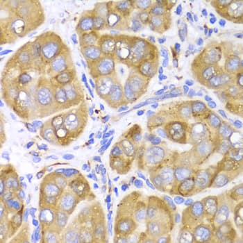 IHC-plus™ LRPAP1 Antibody