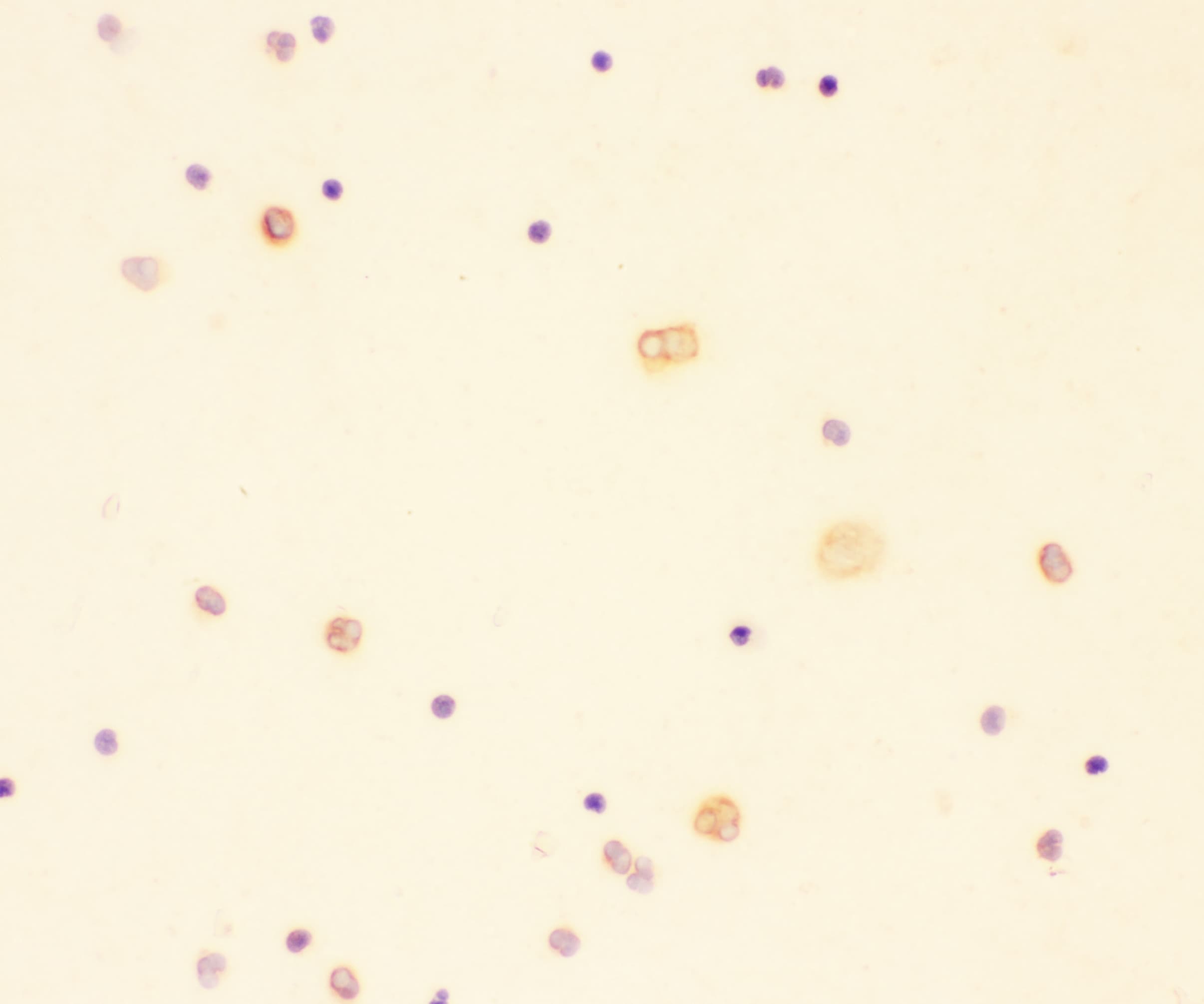 IL18 Antibody (aa37-193)