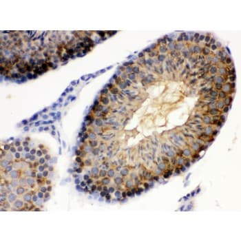 HSP90AA1 / Hsp90 Alpha A1 Antibody (aa454-488)