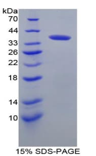 Mouse IRF6 Protein (Recombinant His-T7)