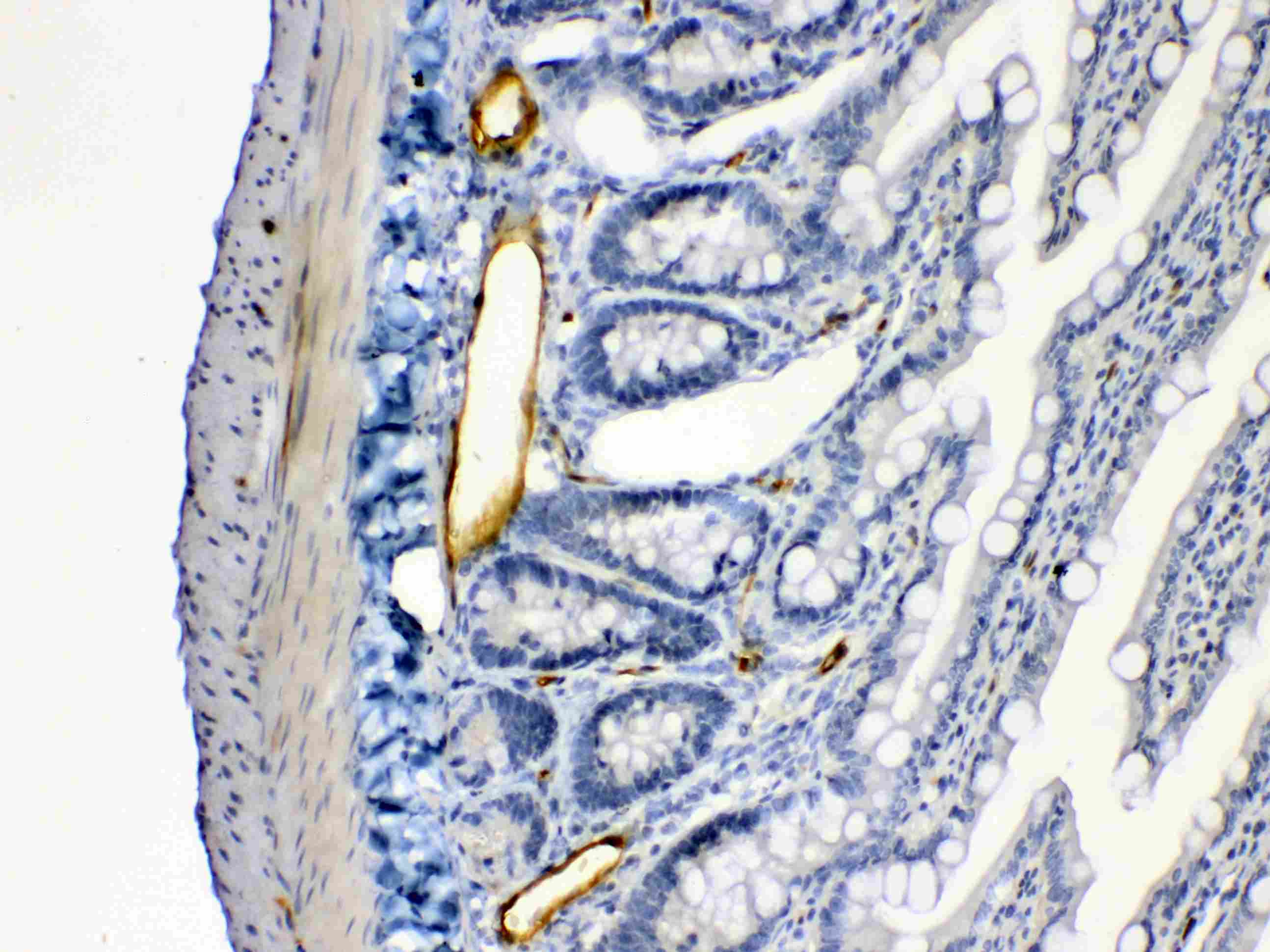 Polyclonal Rabbit anti-Human ANGPTL2 / ARP2 Antibody (IHC, WB)