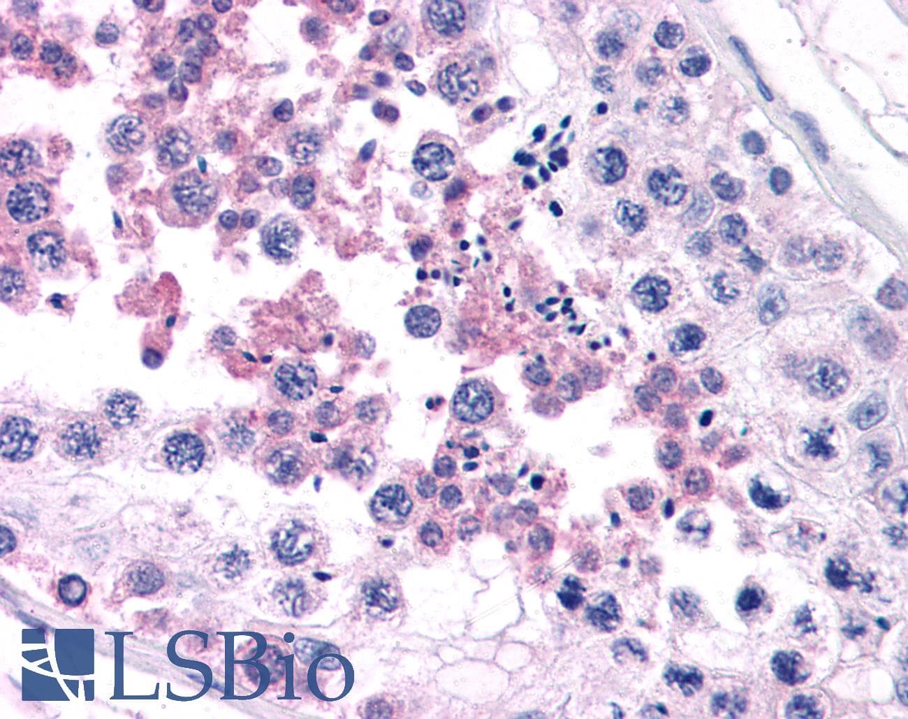 IHC-plus™ LL37 / Cathelicidin Antibody