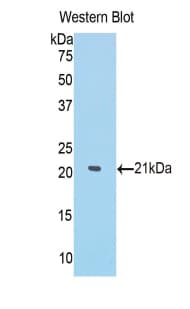 MMP13 Antibody (aa66-238)
