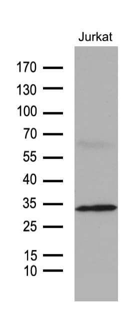 GTPCH1 / GCH1 Antibody (clone OTI1E3)