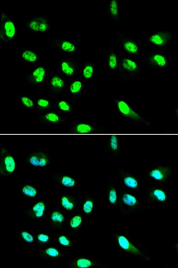 CD32A Antibody
