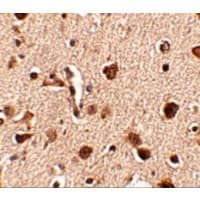 Polyclonal Rabbit anti-Human SLITRK4 Antibody (IHC, IF, WB)