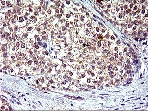 HSD17B4 Antibody (clone OTI2C9)