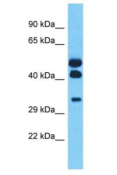 HOXA11 Antibody (aa261-310)