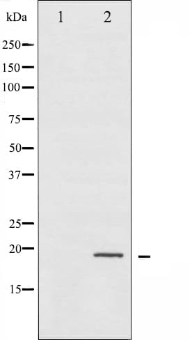 Polyclonal Rabbit anti-Human STMN1 / Stathmin / LAG Antibody (phospho-Ser24, IHC, IF, WB)