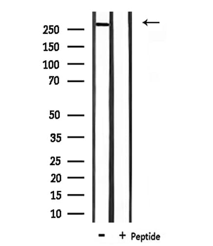 Polyclonal Rabbit anti-Human CREBBP / CREB Binding Protein Antibody (IHC, IF, WB)