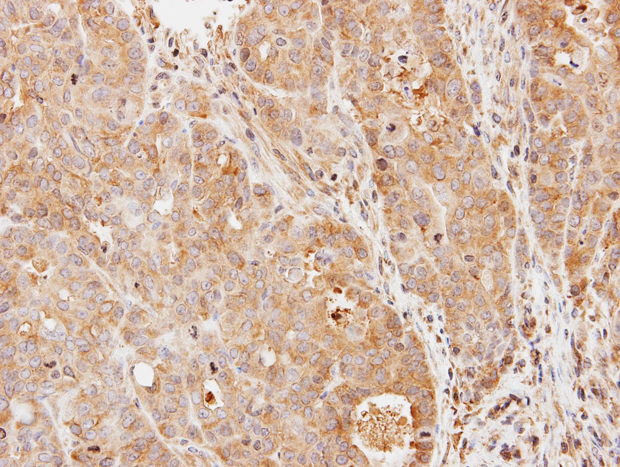 PDE9A Antibody (aa1-216)