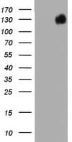Monoclonal Mouse anti-Human BRCA1 Antibody (clone OTI5D10, aa1151-1473, WB)