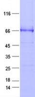 Human VWF / Von Willebrand Factor Protein (Recombinant DDK,C-terminus)