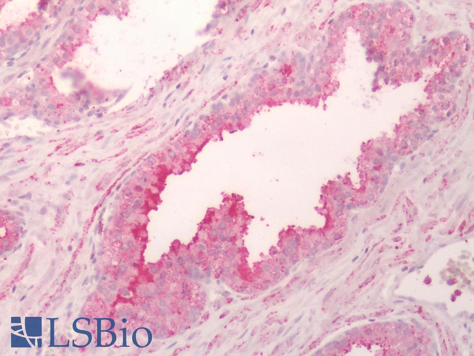 PathPlus™ Polyclonal Rabbit anti-Human HTR4 / 5-HT4 Receptor Antibody (Cytoplasmic Domain, IHC)