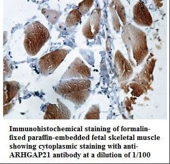 Polyclonal Rabbit anti-Human ARHGAP21 Antibody (aa10-193, IHC, WB)