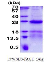 Human NOP16 Protein (Recombinant His)