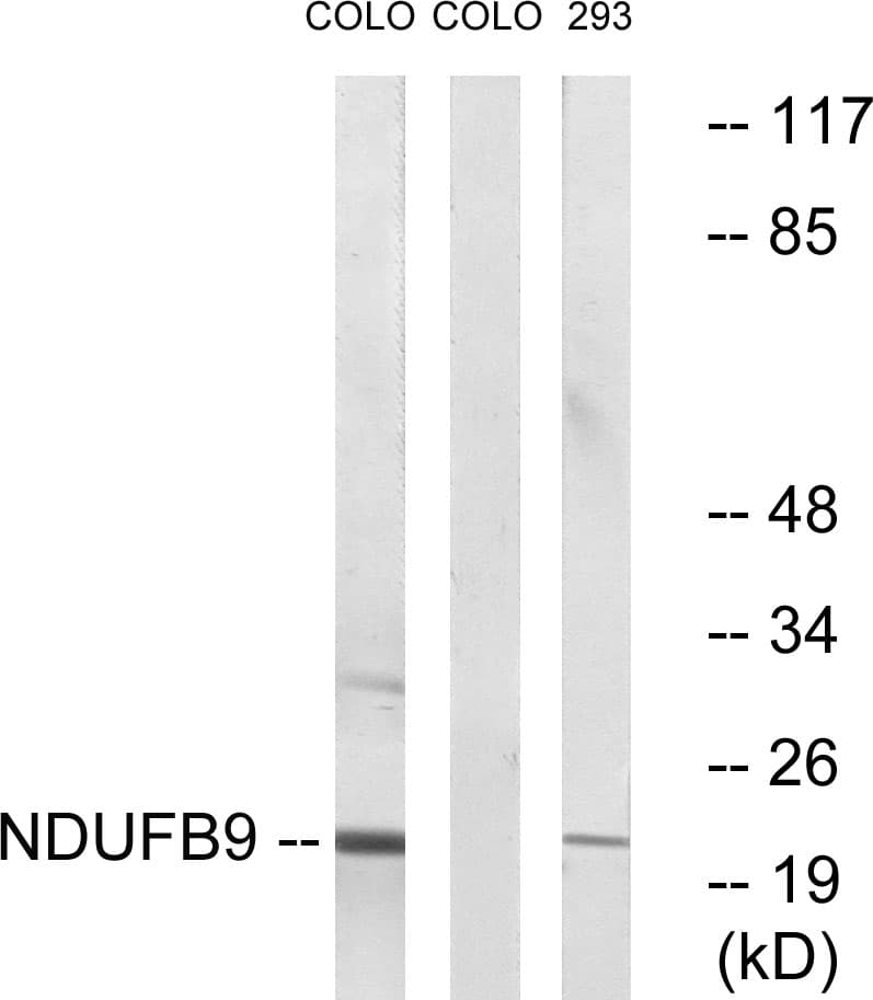 NDUFB9 Antibody (aa102-151)