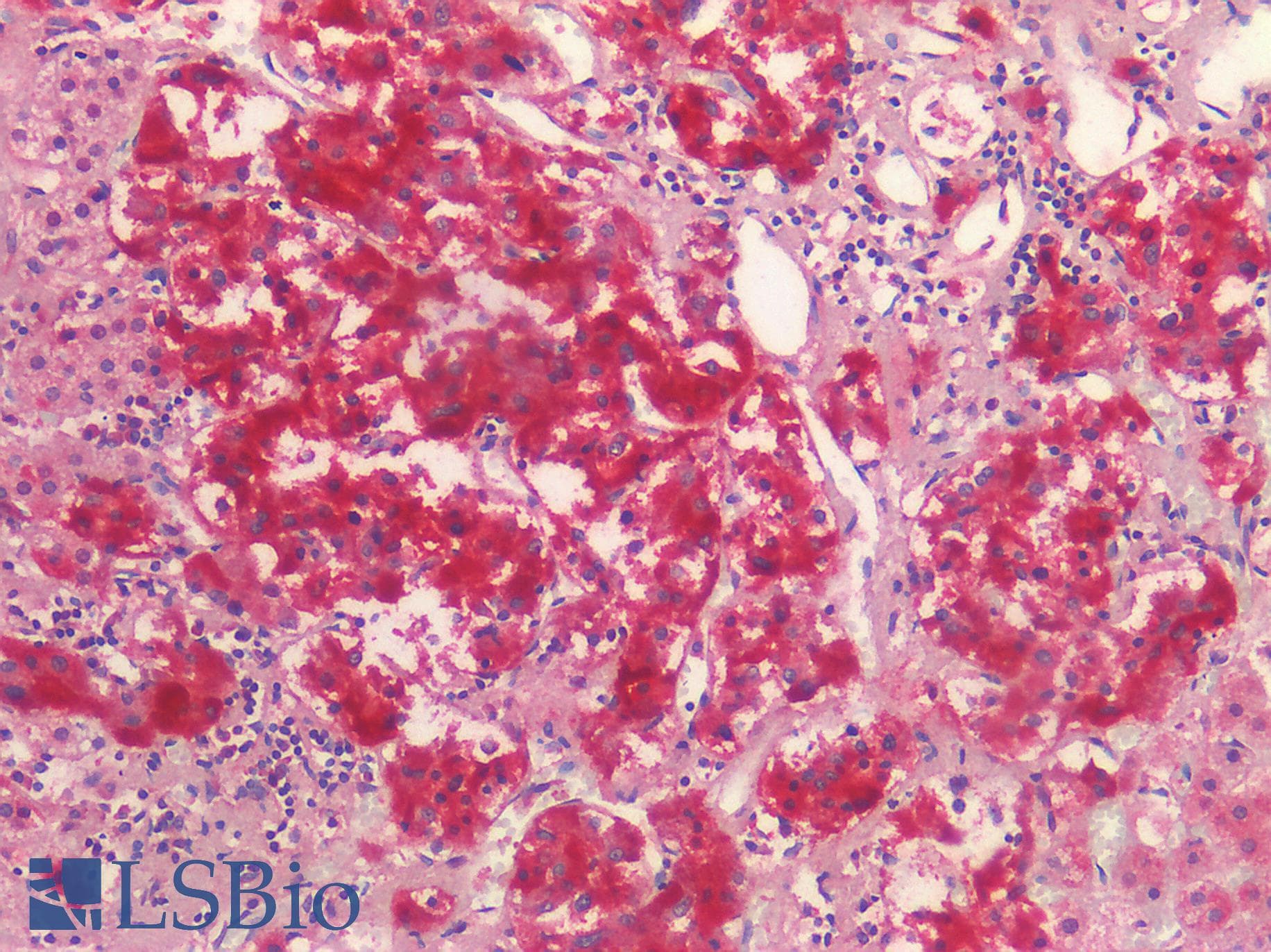IHC-plus™ NOTCH2 Antibody