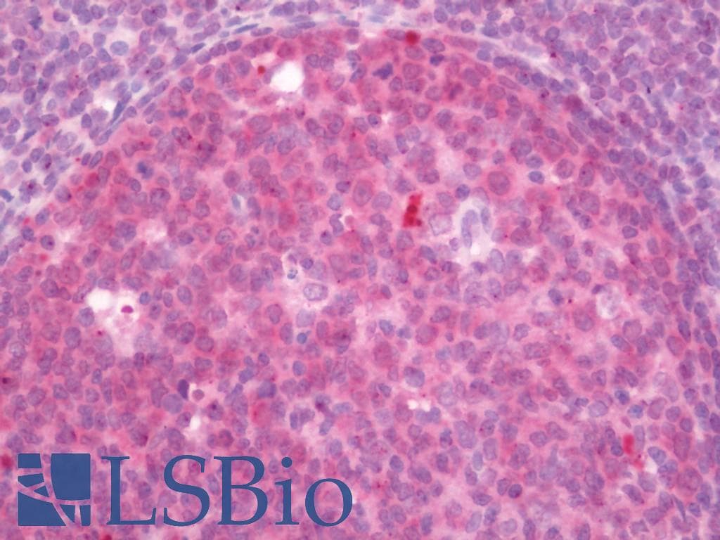 IHC-plus™ NME1 / NM23 Antibody (aa3-52)