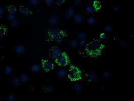 PDHA1 / PDH E1 Alpha Antibody (clone OTI2C10)