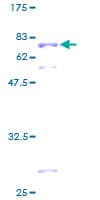 Human SEPHS1 / SPS Protein (Recombinant GST)