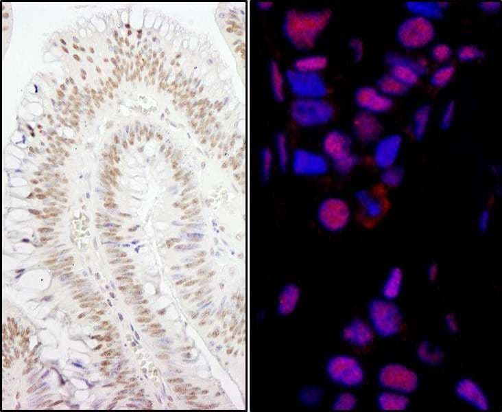Polyclonal Rabbit anti-Human SMEK1 Antibody (aa770-C-term, IHC, IF, WB)