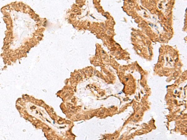 Polyclonal Rabbit anti-Human FAM84A Antibody (IHC, WB)