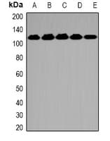 OGT / O-GLCNAC Antibody