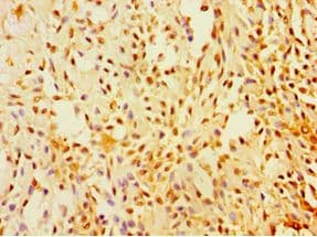 SUGCT / C7orf10 Antibody (aa1-250)