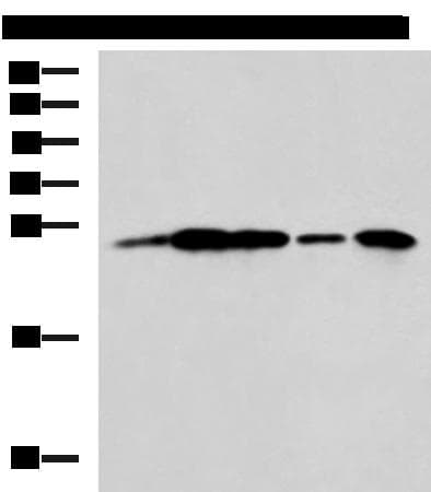 UCHL1 / PGP9.5 Antibody