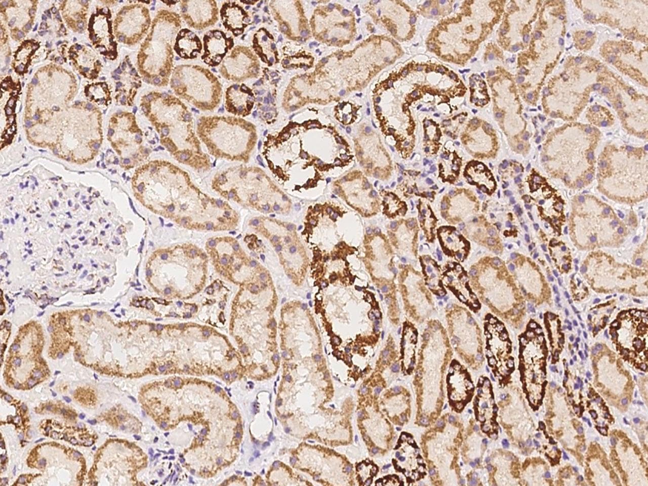 SLU7 / 9G8 Antibody