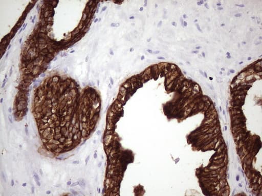 KRT16 / CK16 / Cytokeratin 16 Antibody (clone OTI1G5)