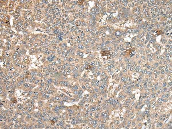 CA11 / Carbonic Anhydrase XI Antibody