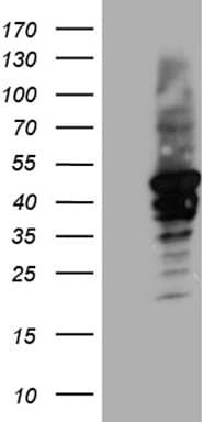 CYTH4 / PSCD4 Antibody (clone OTI4A5)